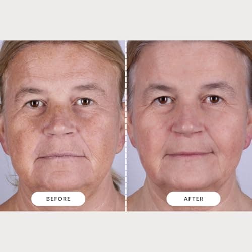 Omnilux Contour Face LED Mask thumbnail 5