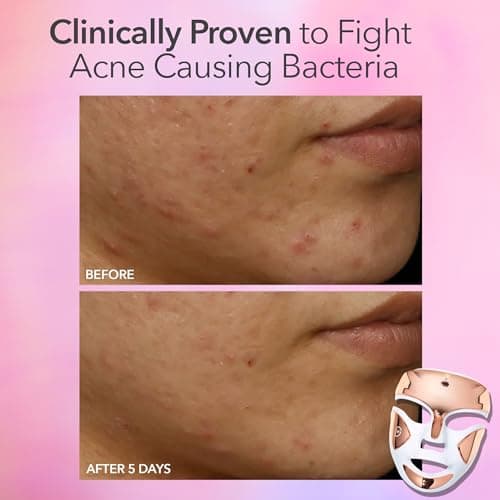 Dr. Dennis Gross DRx SpectraLite FaceWare Pro thumbnail 5