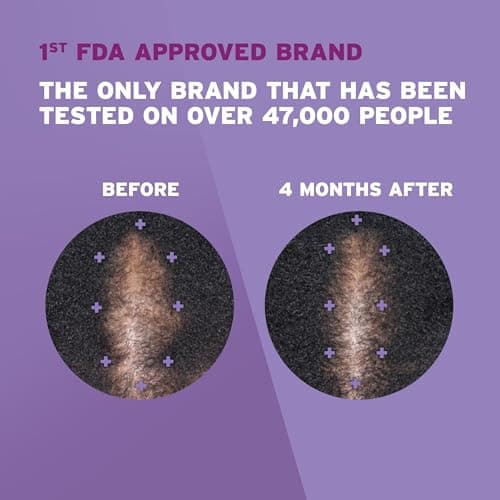 Rogaine Women's 5% Minoxidil Foam thumbnail 4