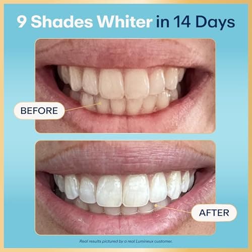 Lumineux Teeth Whitening Strips thumbnail 2