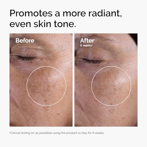 The Ordinary Glycolic Acid 7% Exfoliating Toner thumbnail 2