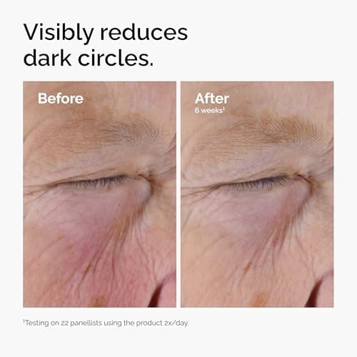 The Ordinary Caffeine Solution 5% + EGCG thumbnail 5