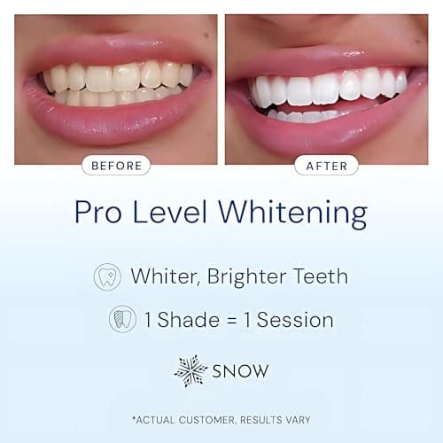 Snow Teeth Whitening Kit thumbnail 2