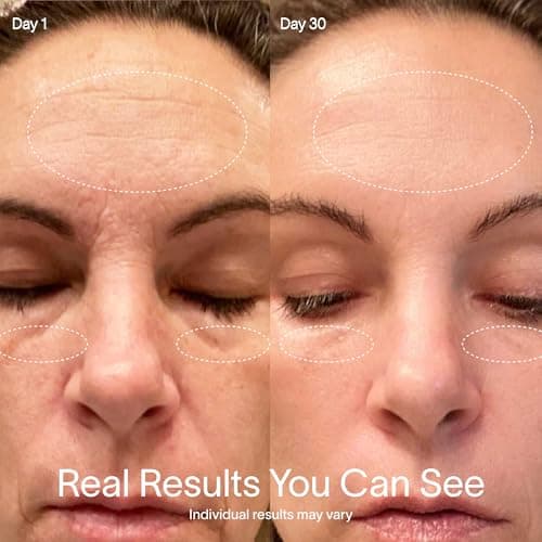 SolaWave 4-in-1 Radiant Renewal Skincare Wand thumbnail 4