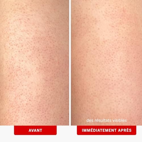 First Aid Beauty KP Bump Eraser Body Scrub with 10% AHA thumbnail 3