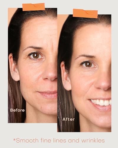 NEWKEY LED Face Mask with Neck Coverage thumbnail 4