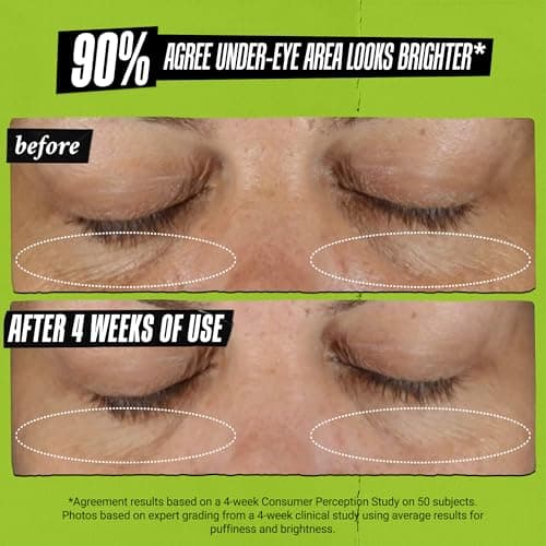 Kiehl's Creamy Eye Treatment with Avocado thumbnail 5