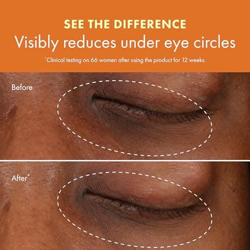 Origins GinZing Refreshing Eye Cream to Brighten and Depuff thumbnail 5