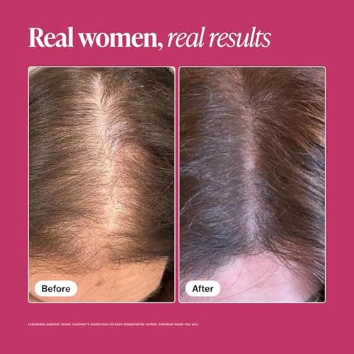 Viviscal Hair Growth Supplements for Women thumbnail 5