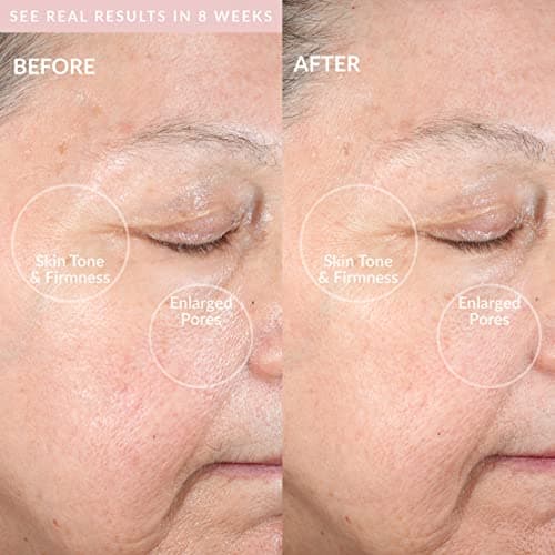 PMD Clean Pro RQ Smart Facial Cleansing Device thumbnail 4