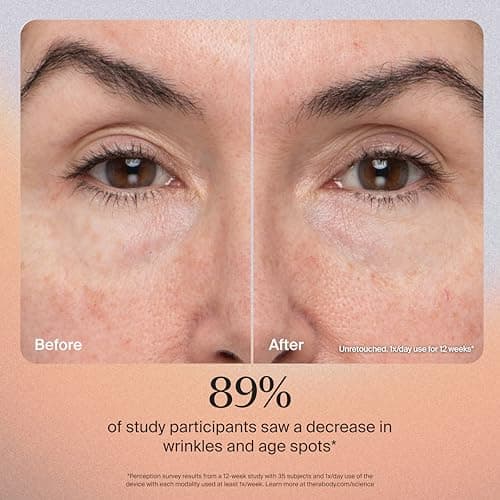 TheraFace Pro 8-in-1 Facial Treatment Device thumbnail 3