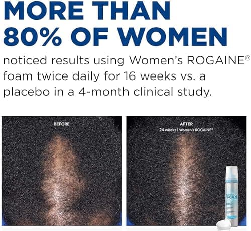 Rogaine Women's 5% Minoxidil Foam thumbnail 5