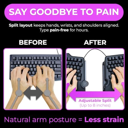 Cloud Nine C989M Ergonomic Mechanical Split Keyboard thumbnail 3
