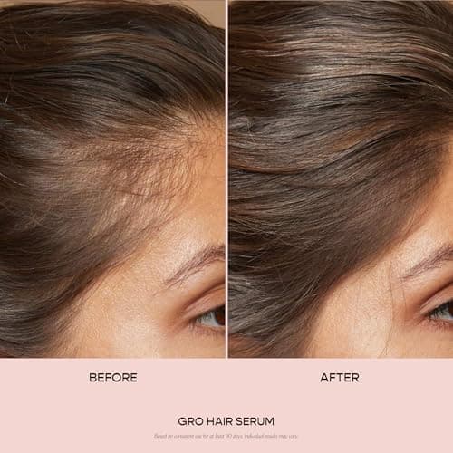 VEGAMOUR GRO Hair Serum thumbnail 2