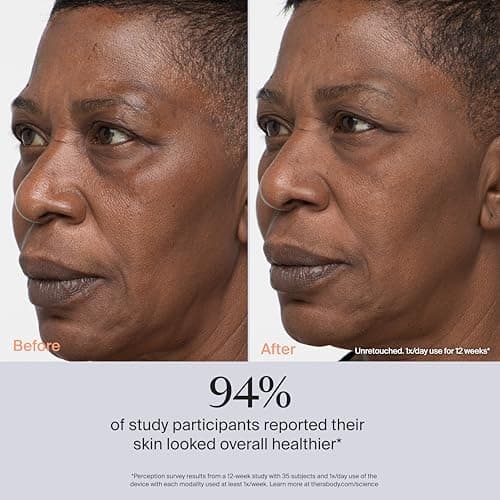 TheraFace Pro 8-in-1 Facial Treatment Device thumbnail 4