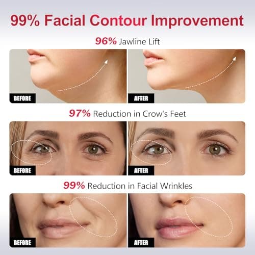 Ziip Beauty Ziip Halo Microcurrent Device thumbnail 5