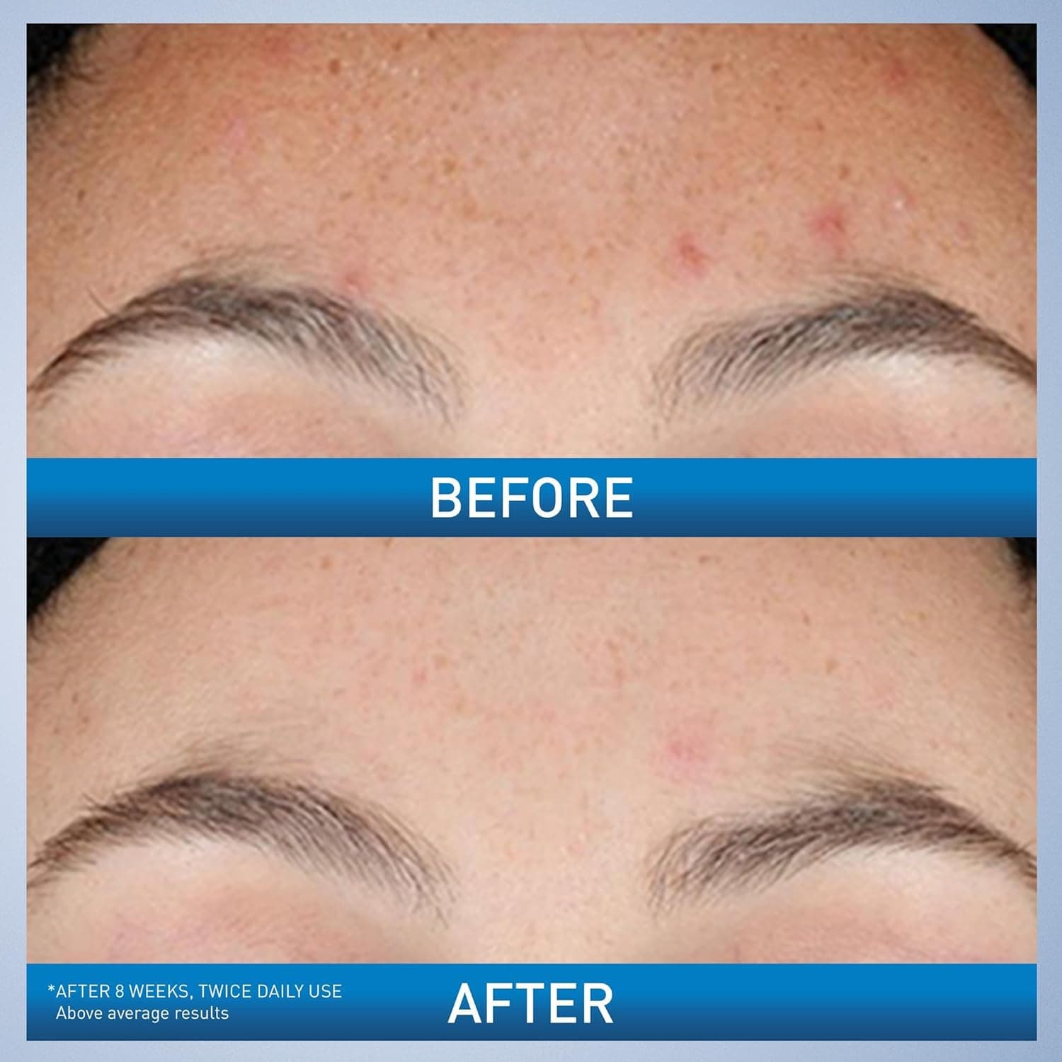 CeraVe Resurfacing Retinol Serum thumbnail 3