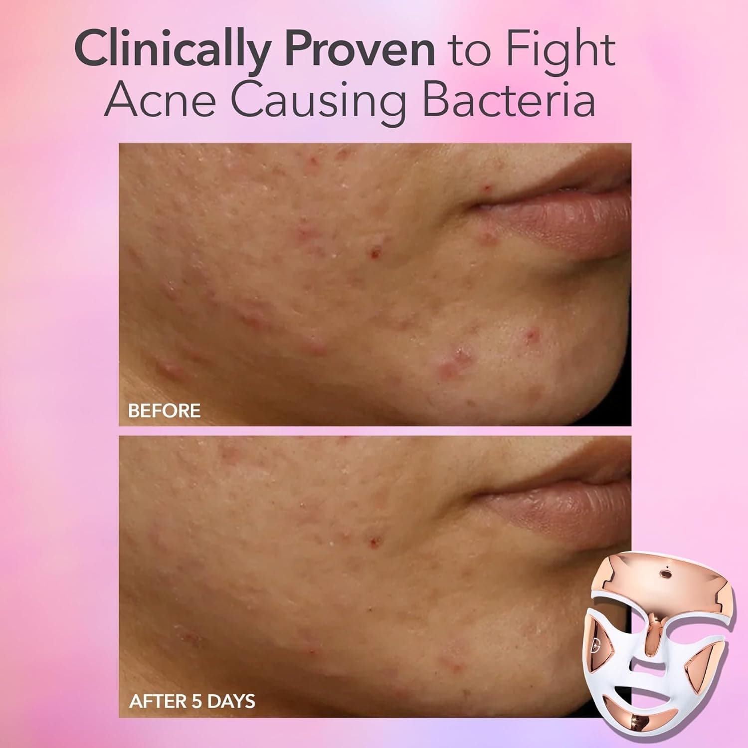 Dr. Dennis Gross DRx SpectraLite FaceWare Pro thumbnail 5