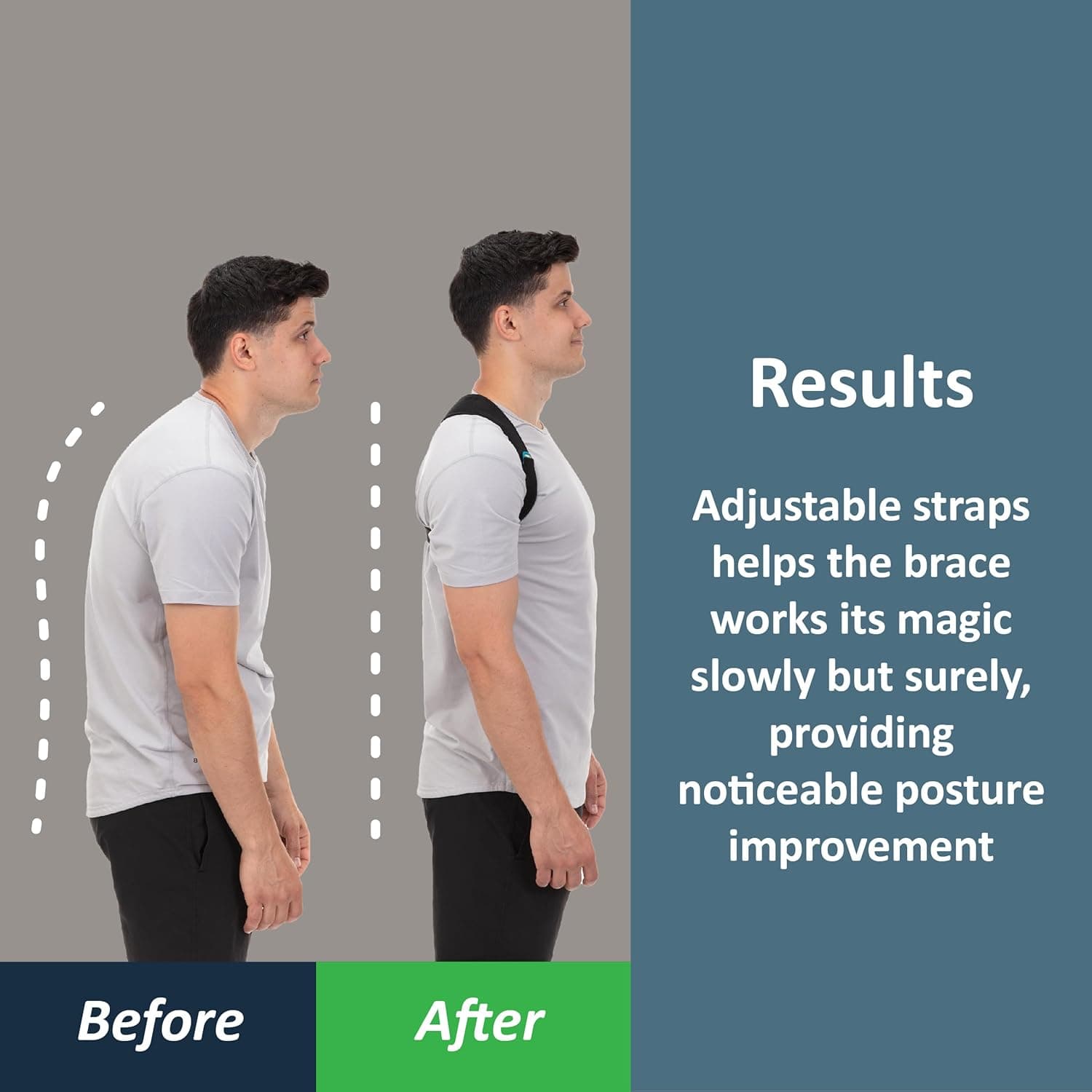 ComfyBrace Posture Corrector Back Brace thumbnail 2