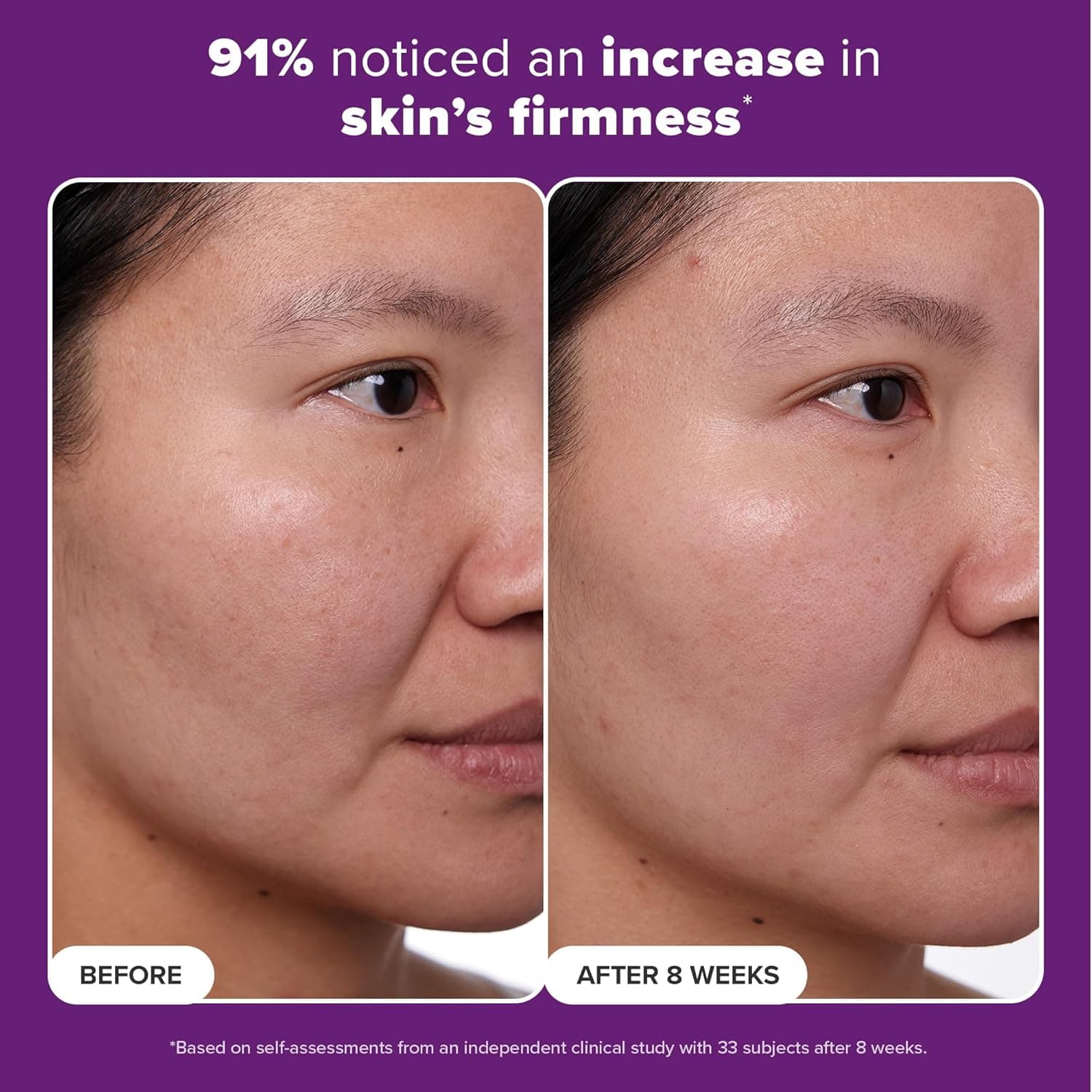 Paula's Choice Clinical 1% Retinol Treatment thumbnail 4