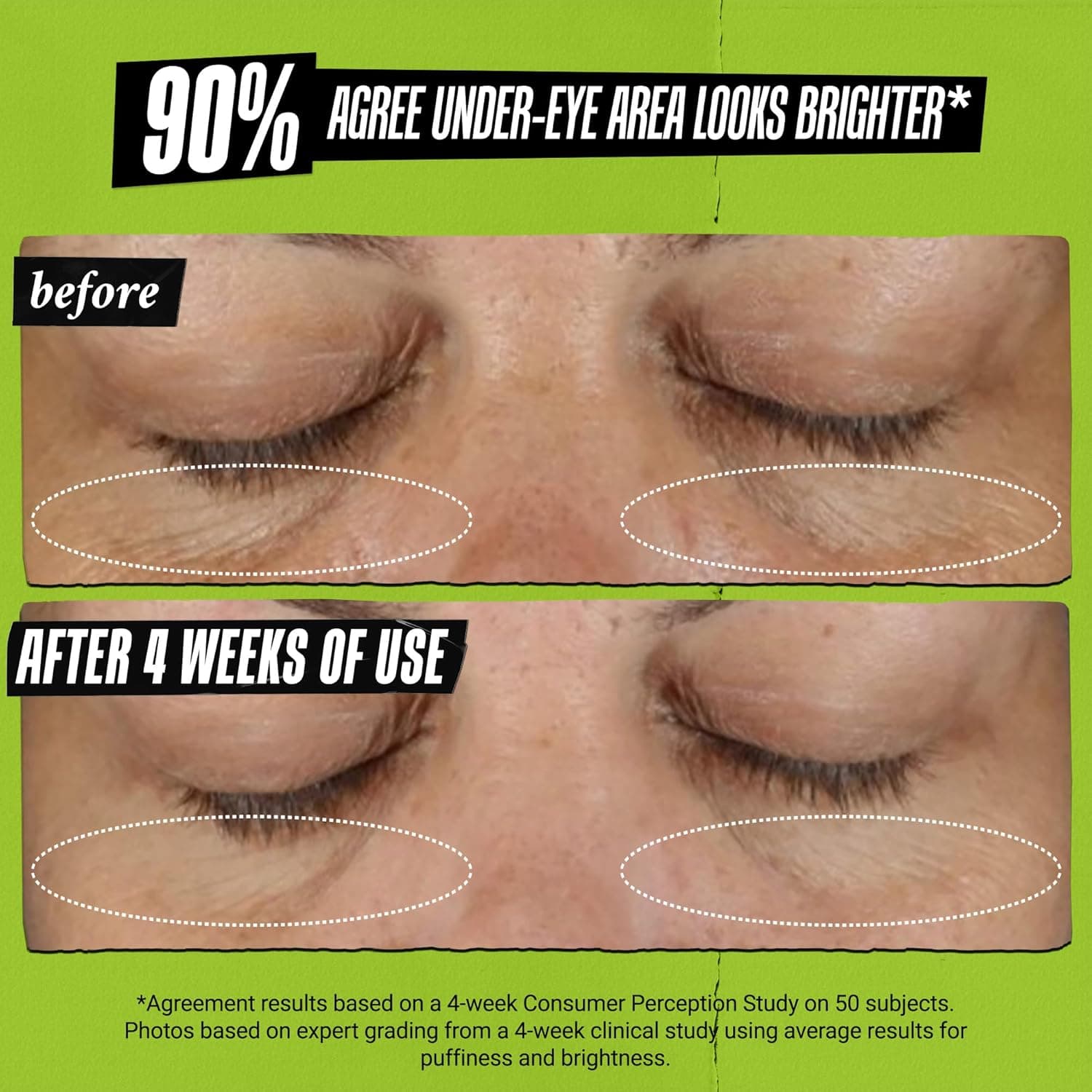 Kiehl's Creamy Eye Treatment with Avocado thumbnail 5