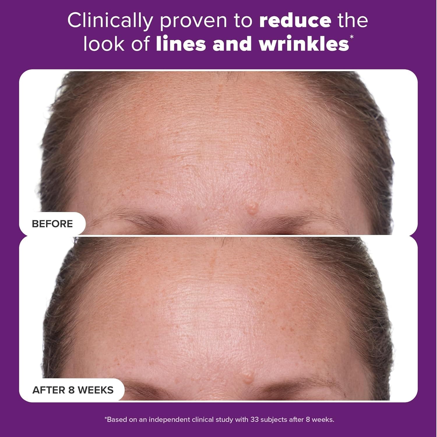 Paula's Choice Clinical 1% Retinol Treatment thumbnail 3