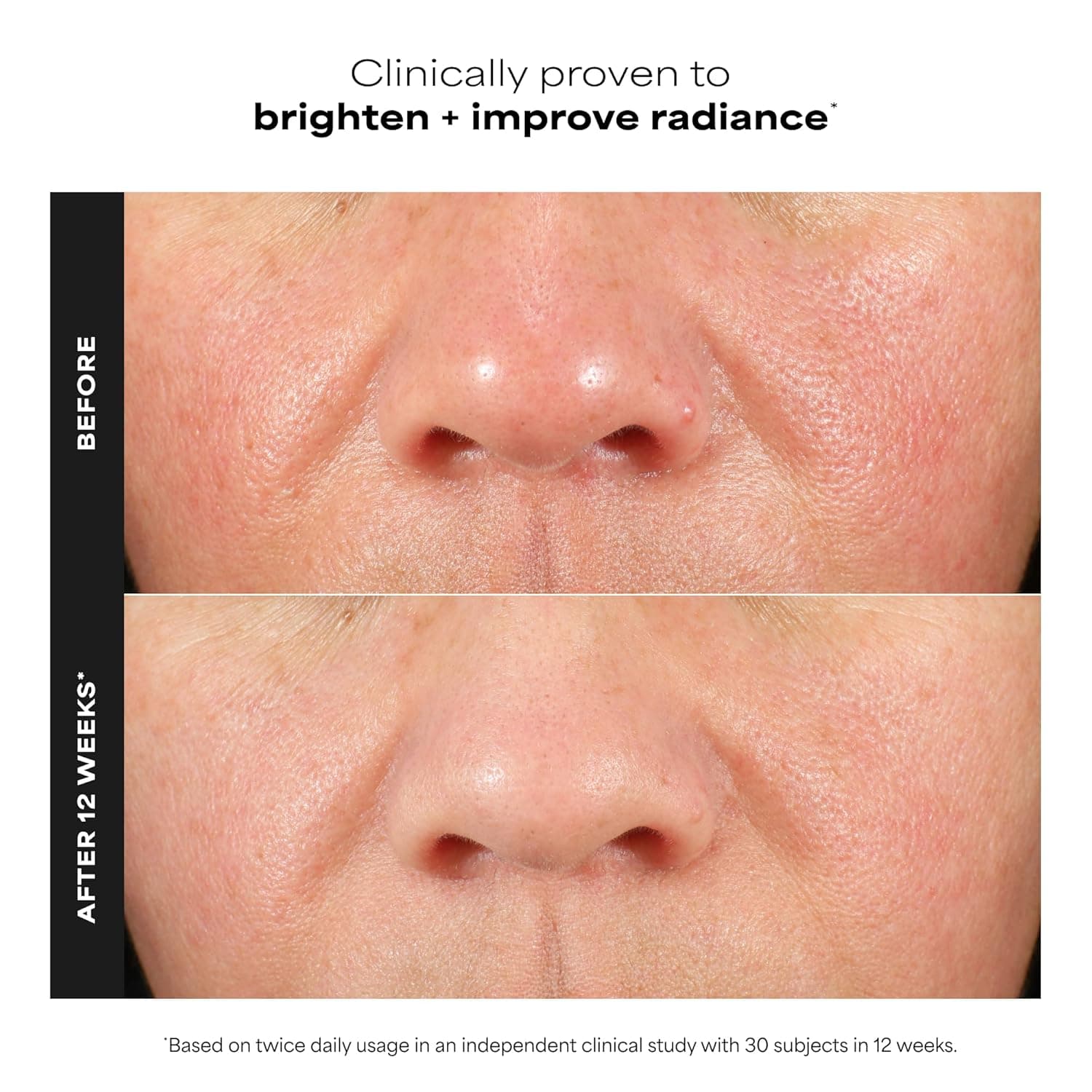 Paula's Choice BOOST C15 Super Booster thumbnail 2