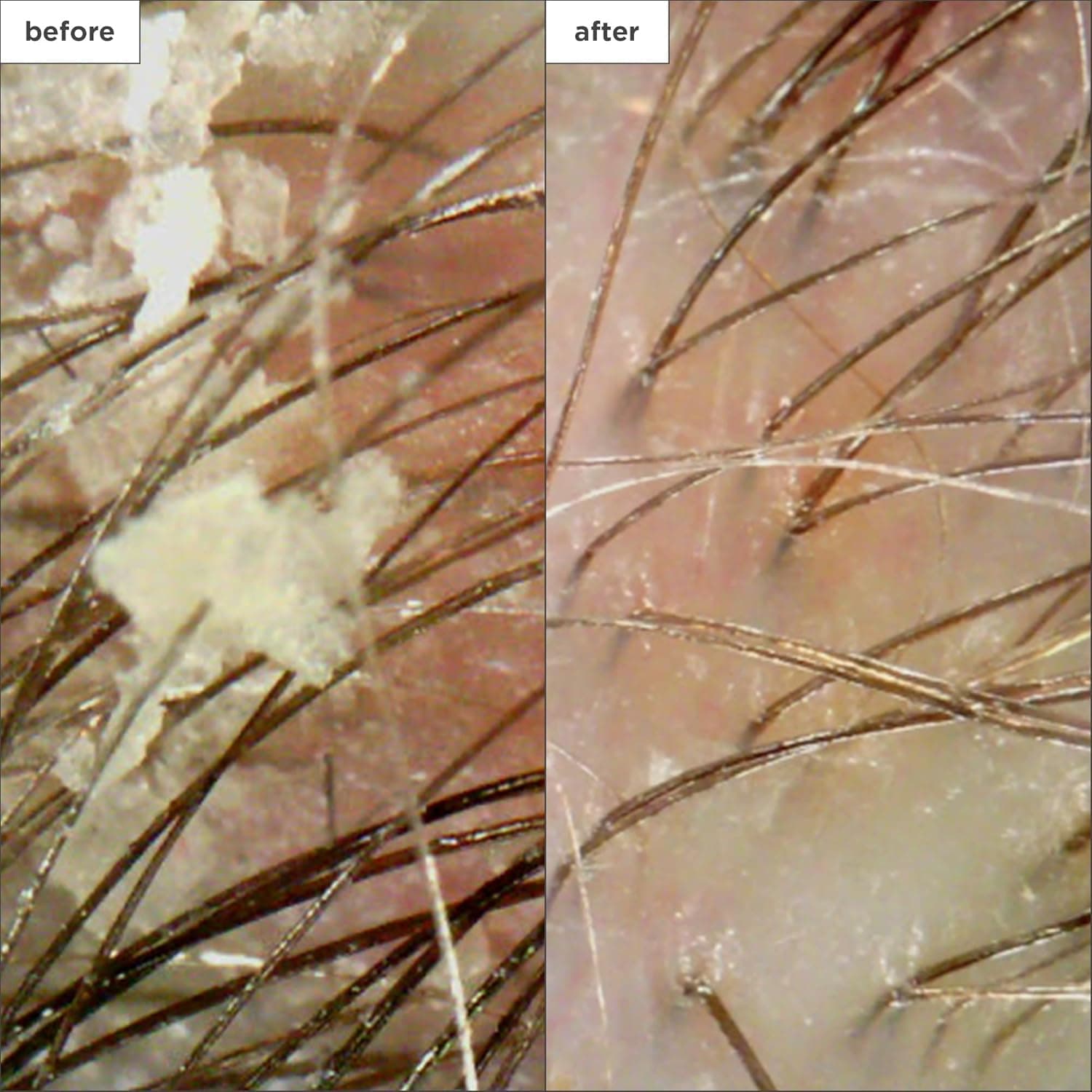 Briogeo Scalp Revival Charcoal + Coconut Oil Micro-Exfoliating Shampoo thumbnail 4