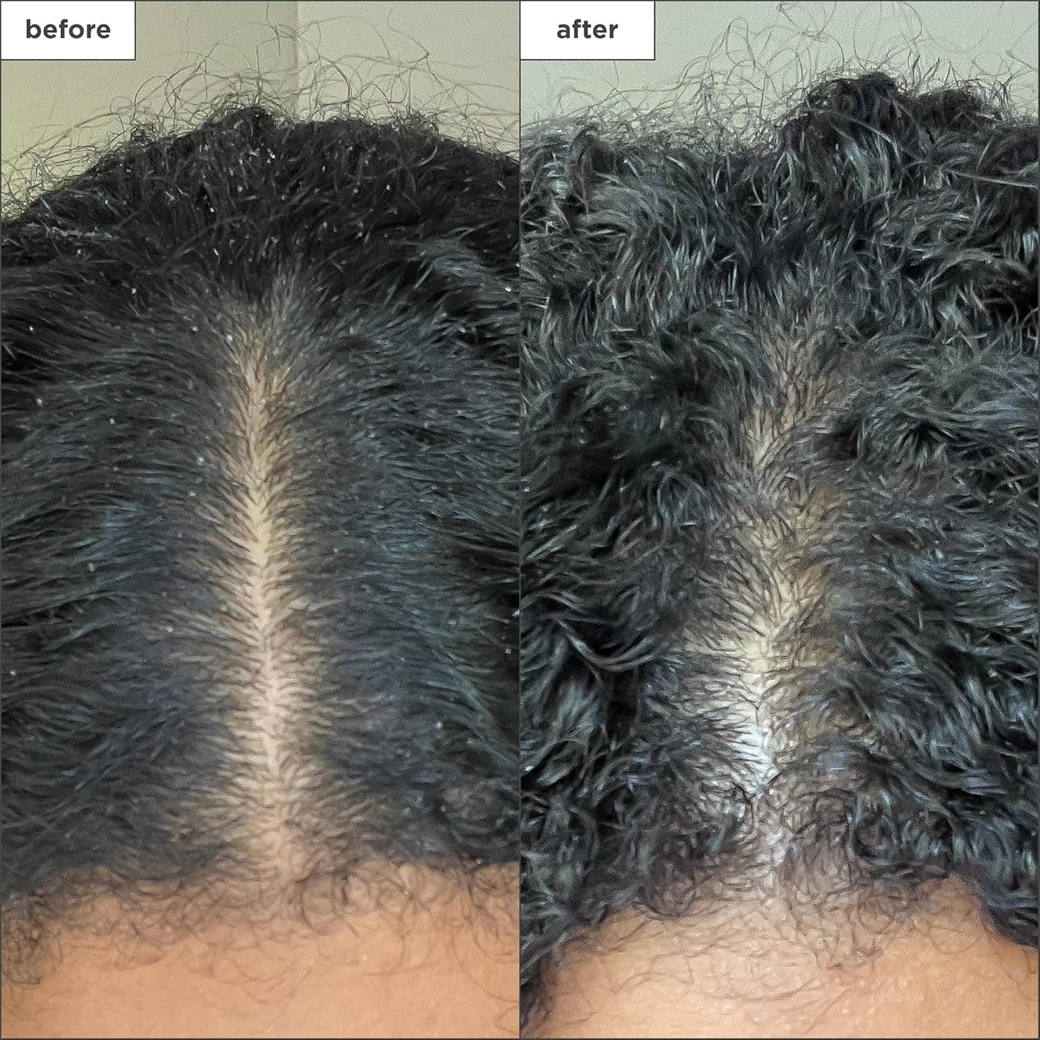 Briogeo Scalp Revival Charcoal + Coconut Oil Micro-Exfoliating Shampoo thumbnail 5