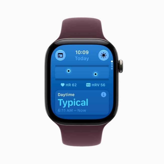 Apple Watch Series 12, The new Health Sensing System and Readiness score 2